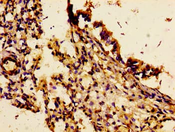 Polyclonal Rabbit anti-Human CDw218a / IL18R1 Antibody (IHC, WB)