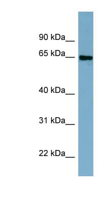 CBFA2T2 / MTGR1 Antibody (C-Terminus)