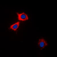 CaMKII Alpha+Delta Antibody (Internal)