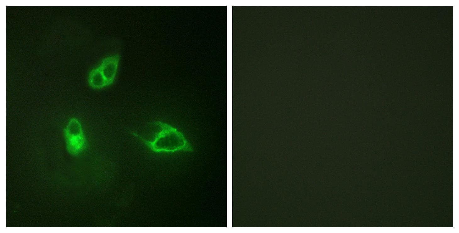 CXCR2 Antibody