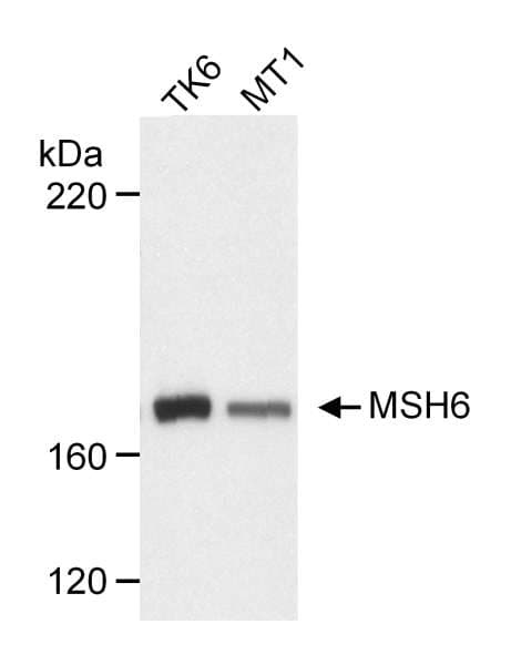 Polyclonal Rabbit anti-Human MSH6 Antibody (aa1300-C-term, IHC, WB)