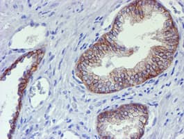 ERBB2 / HER2 Antibody (aa676-1255, clone OTI11A7, Carrier-free)