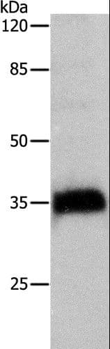 CTSZ / Cathepsin Z Antibody