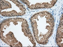 ACAT2 Antibody (clone OTI5A2)