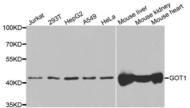 IHC-plus™ Aspartate Aminotransferase Antibody