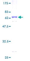 Human PRSS8 / Prostasin Protein (Recombinant GST)