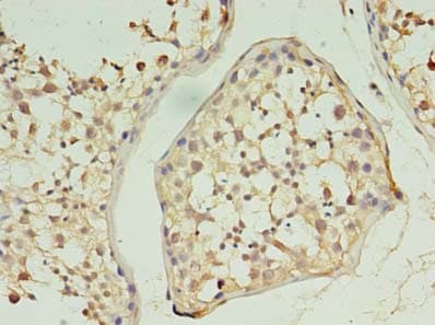 Polyclonal Rabbit anti-Human KLHL12 Antibody (IHC)