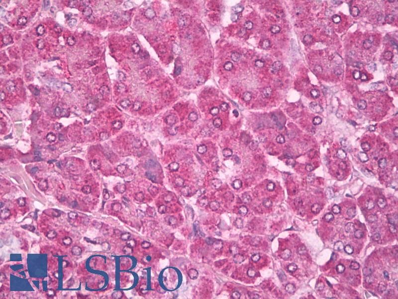 IHC-plus™ RAB4A / RAB4 Antibody