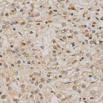 LETMD1 / HCCR1 Antibody