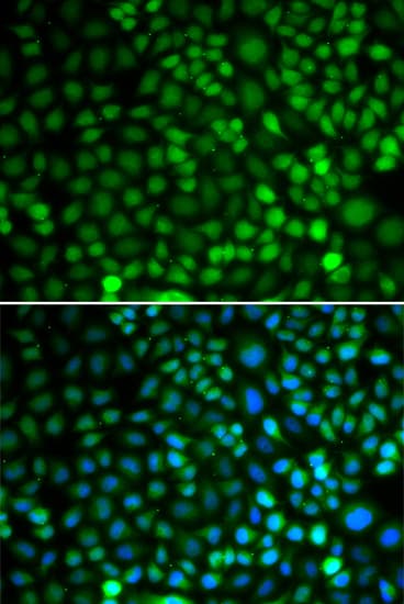 KIF2C / MCAK Antibody