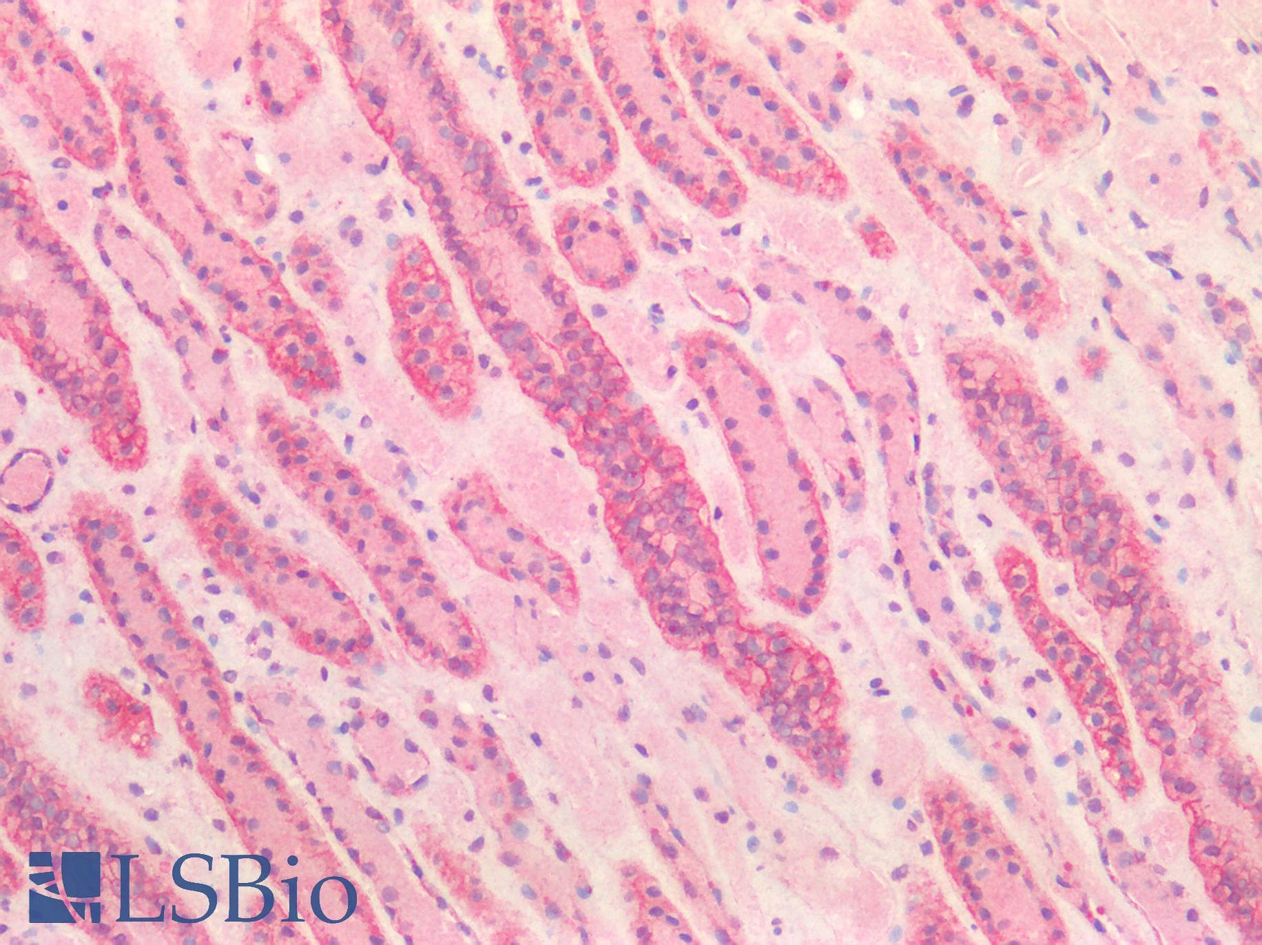 PathPlus™ Polyclonal Rabbit anti-Human CTNND1 / p120 Catenin Antibody (IHC)