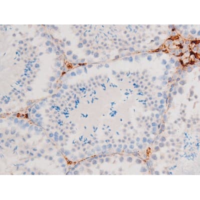 SMAD3 Antibody (phospho-Ser213)