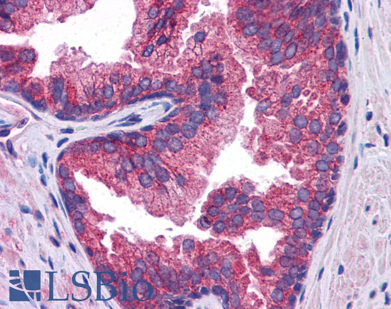 IHC-plus™ SLC39A10 / ZIP10 Antibody