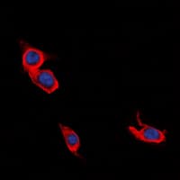 Polyclonal Rabbit anti-Human L1CAM Antibody (C-Terminus, IF, WB)