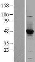 ACOT1 Protein (Over-Expression Lysate Myc-DDK (Flag))