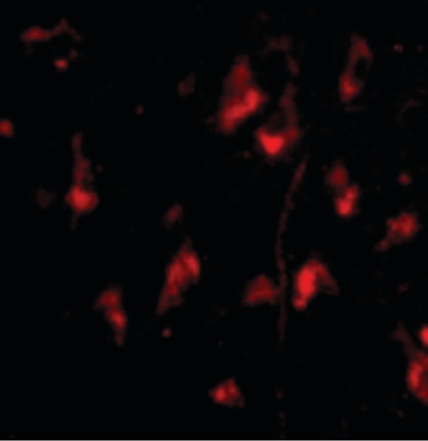 APG12 / ATG12 Antibody