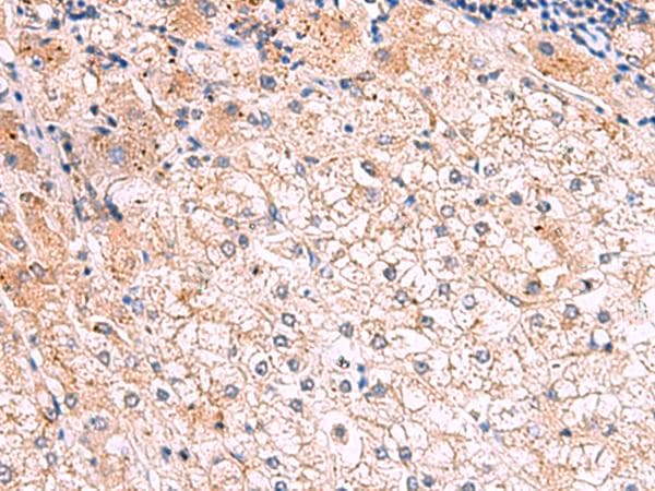 KLK9 / Kallikrein 9 Antibody
