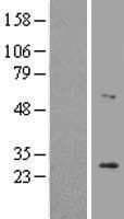 LRAT Protein (Over-Expression Lysate Myc-DDK (Flag))