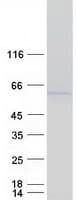 Human TXNIP Protein (Recombinant Myc-DDK (Flag))