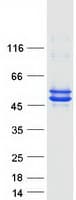 Human CKMT1B Protein (Recombinant Myc-DDK (Flag))