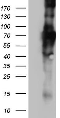 CD68 Antibody (aa22-319, clone OTI4E3, Carrier-free)