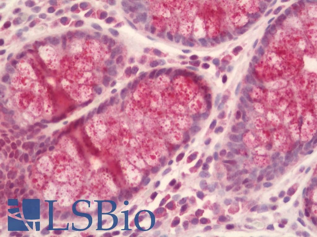 IHC-plus™ SMOC1 Antibody (aa284-313)