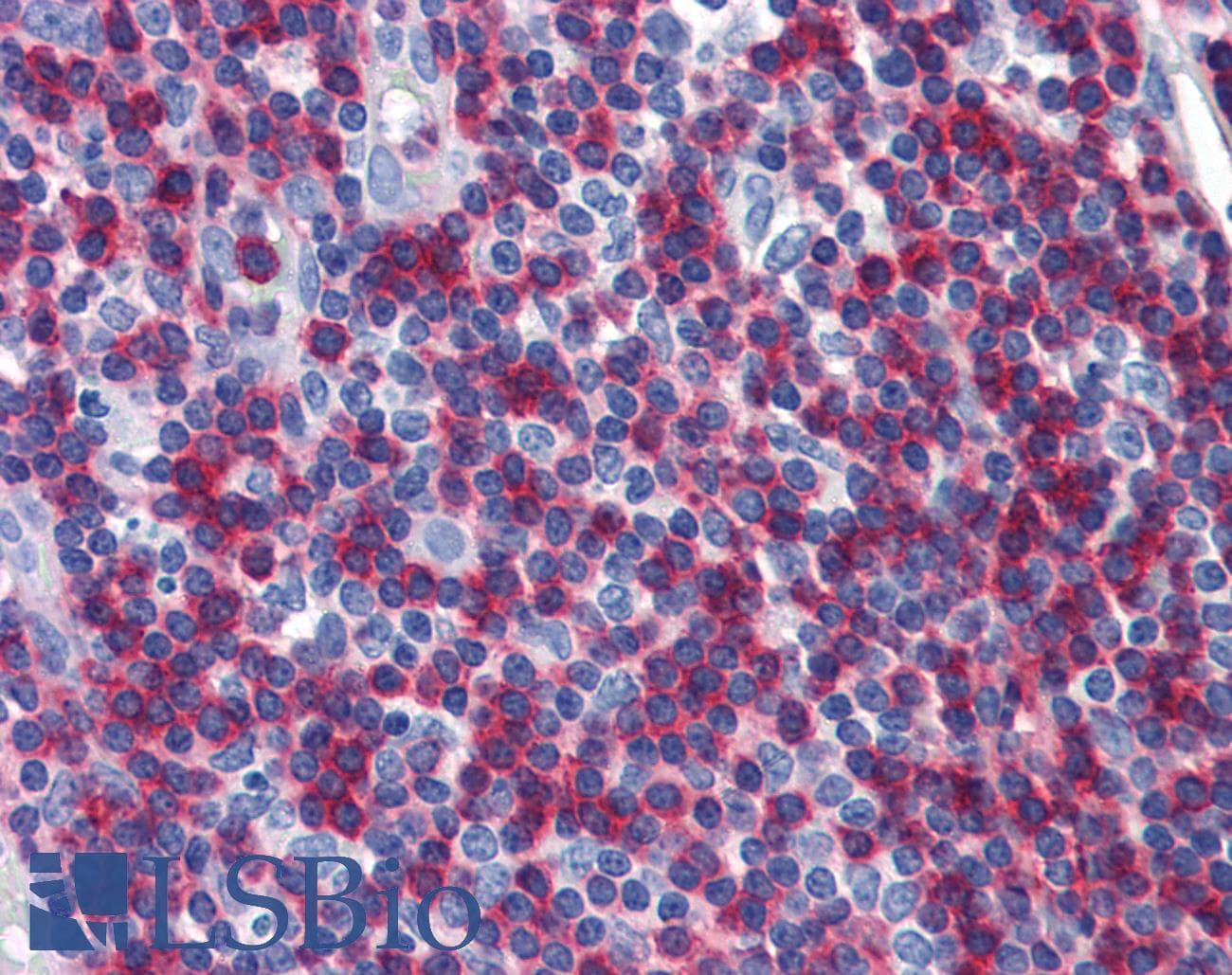 IHC-plus™ ADD1 / Adducin Alpha Antibody (C-Terminus, clone EP734Y)
