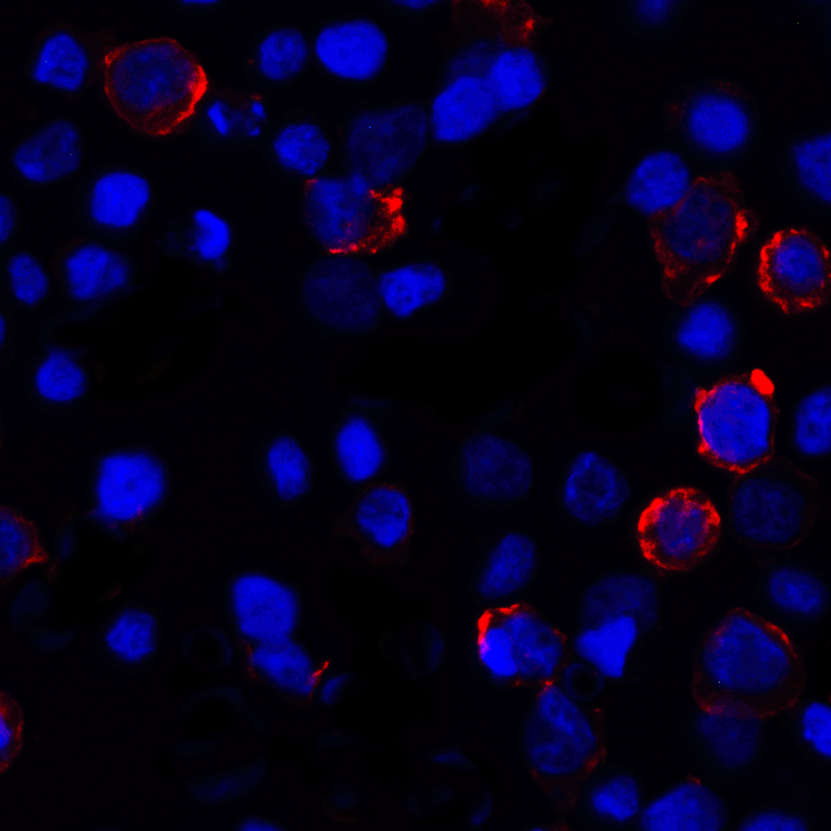 CD274 / B7-H1 / PD-L1 Antibody (clone 8E12)
