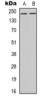 BRCA1 Antibody (C-Terminus)