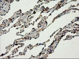 CAT / Catalase Antibody (clone OTI3C3)