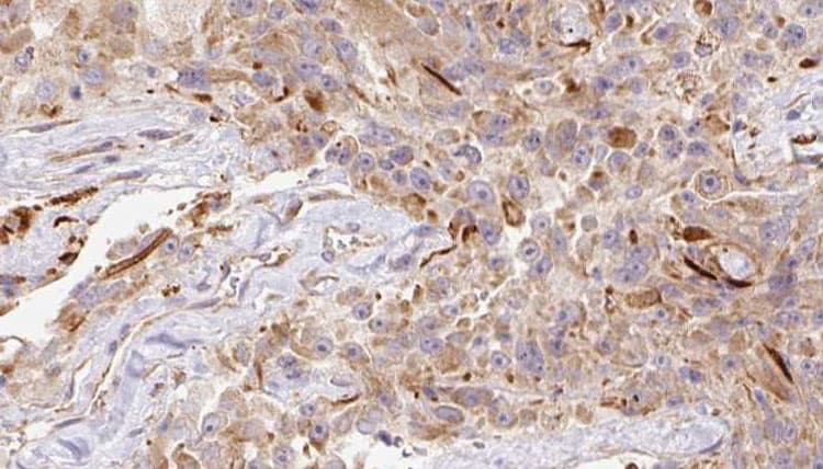 LGALS1 / Galectin 1 Antibody