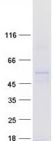 Human RRNAD1 / C1orf66 Protein (Recombinant Myc-DDK (Flag))