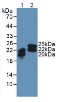 LCN2 / Lipocalin 2 / NGAL Antibody (aa21-198)