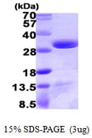 Human DCUN1D1 / SCCRO Protein (Recombinant His)