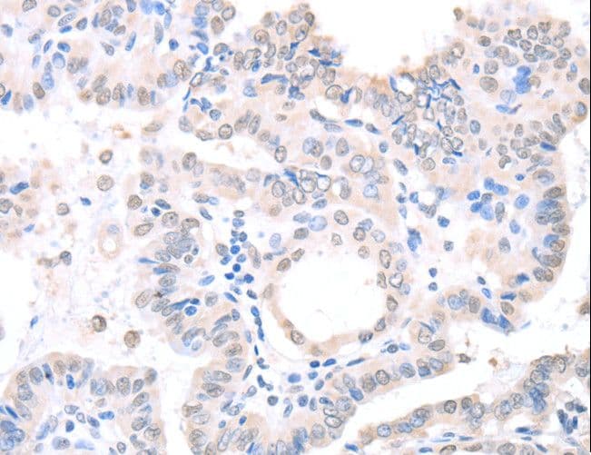 APEX1 / APE1 Antibody