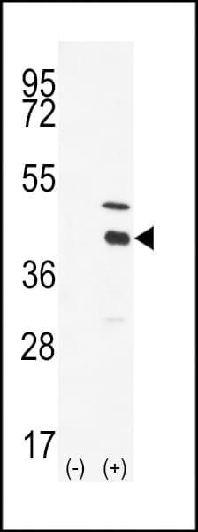 DOK4 Antibody (aa228-258)