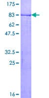 Human MKRN1 Protein (Recombinant GST)