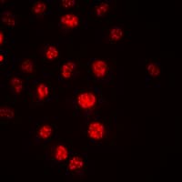 APC6 / CDC16 Antibody (C-Terminus)