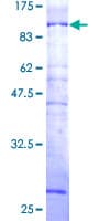 Human N4BP2L2 Protein (Recombinant GST)
