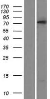 PRDM5 Protein (Over-Expression Lysate Myc-DDK (Flag))