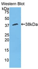 ANXA5 / Annexin V Antibody (aa1-319, FITC)