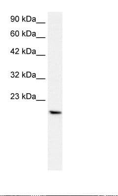 PTHLH / PTHRP Antibody (C-Terminus)