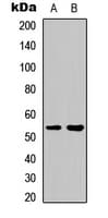 GBA3 / CBG Antibody (Internal)