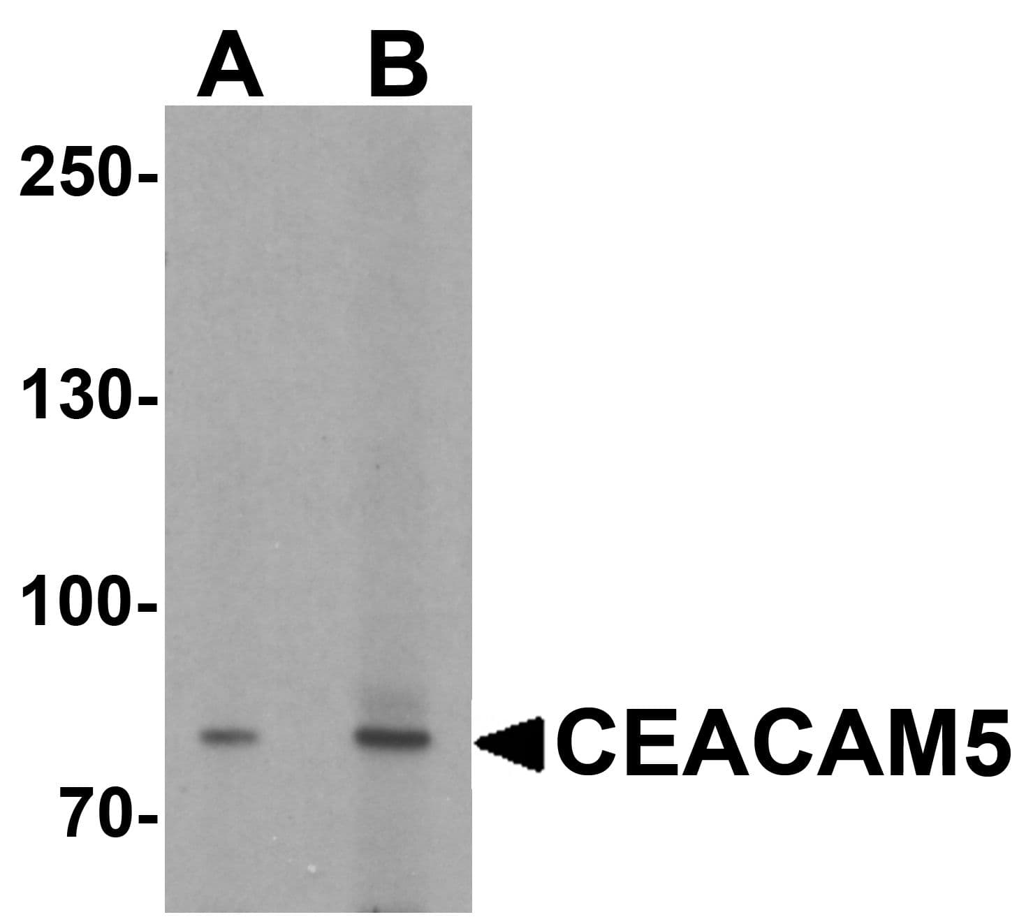 CEACAM5 / CD66e Antibody