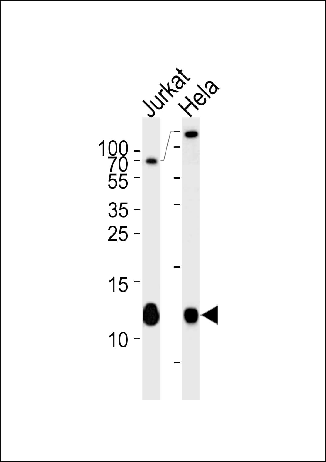 B2M / Beta 2 Microglobulin Antibody (aa10-39)