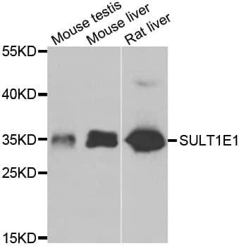 Polyclonal Rabbit anti-Human SULT1E1 / Sulfotransferase 1E1 Antibody (IHC, IF, WB)