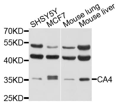 CA4 / Carbonic Anhydrase IV Antibody