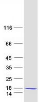 Human LAMTOR2 Protein (Recombinant Myc-DDK (Flag))