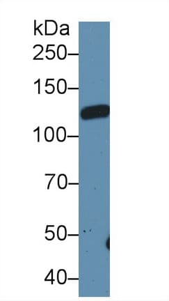 CD118 / LIF Receptor Alpha Antibody (aa152-291, APC)
