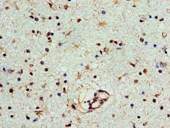 Polyclonal Rabbit anti-Human PNP / Nucleoside Phosphorylase Antibody (aa1-289, IHC, WB)